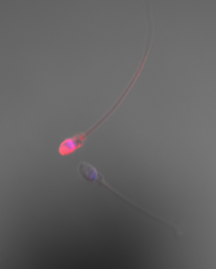 PS Stained sperm illustration